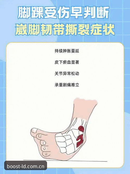 8周伤停，一个脚踝韧带撕裂背后的逻辑